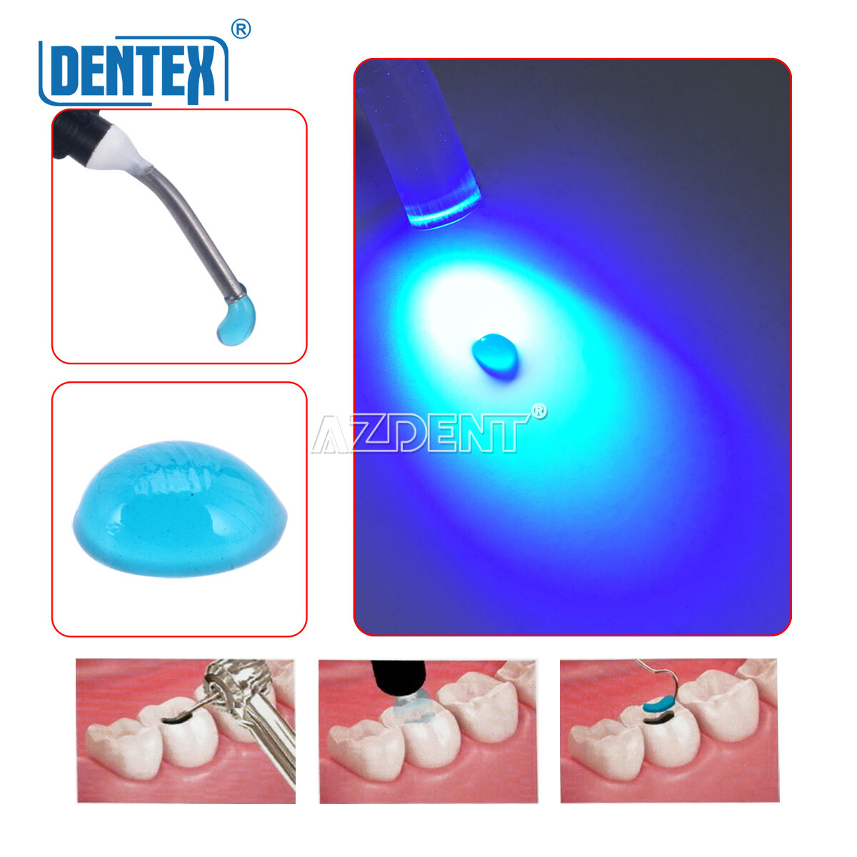 DENTEX Dental Temporary Flowable Resin Prepare For Filling Teeth Cavity Material