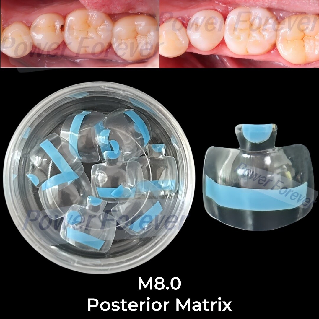 M8.0 Dental Posterior Clear Matrix Restorative BT Bow Matrices Fit BioClear