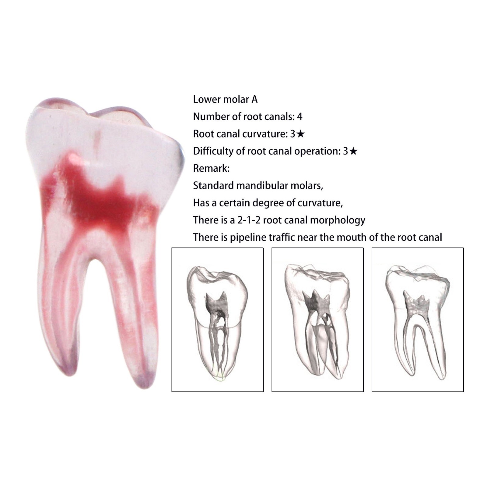 Dental Training 3D RCT Endo Tooth Model Practice Model Curved Root Resin Teeth