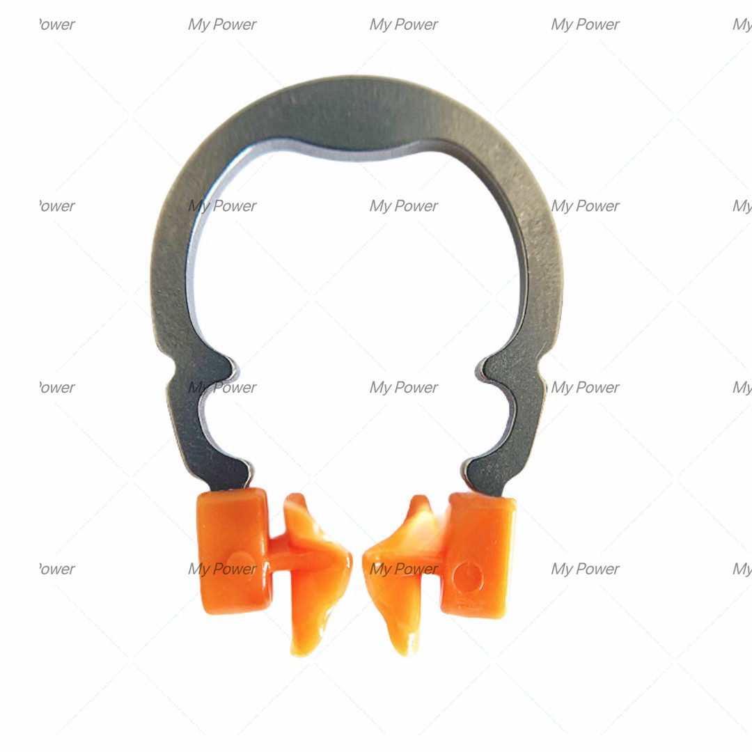 Dental Titanium Ring NITI Clamping Sectional Matrix Band Matrice Non-Deformation