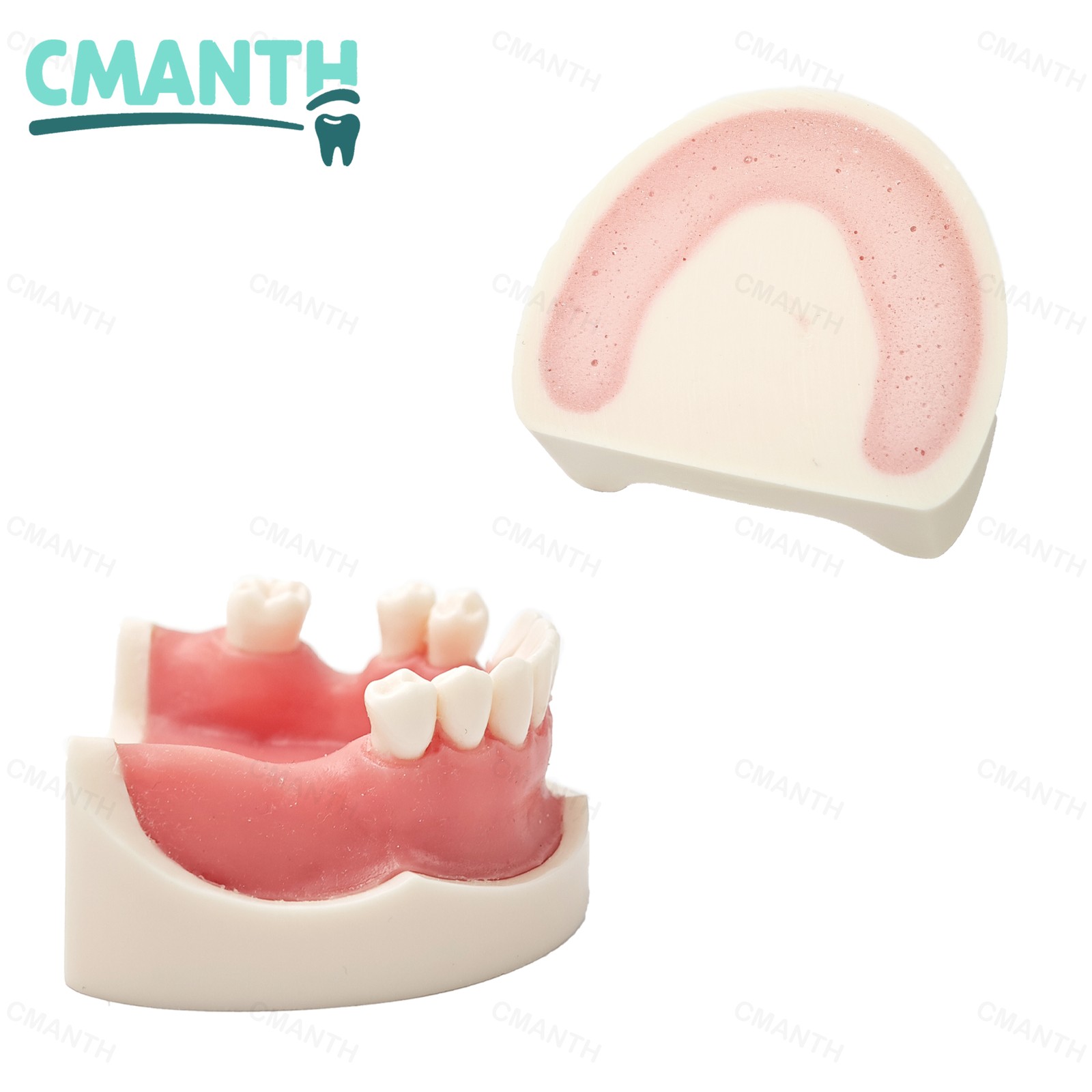 US Dental Implant Model Soft Gums Model Drilling Training Open Suture Practice