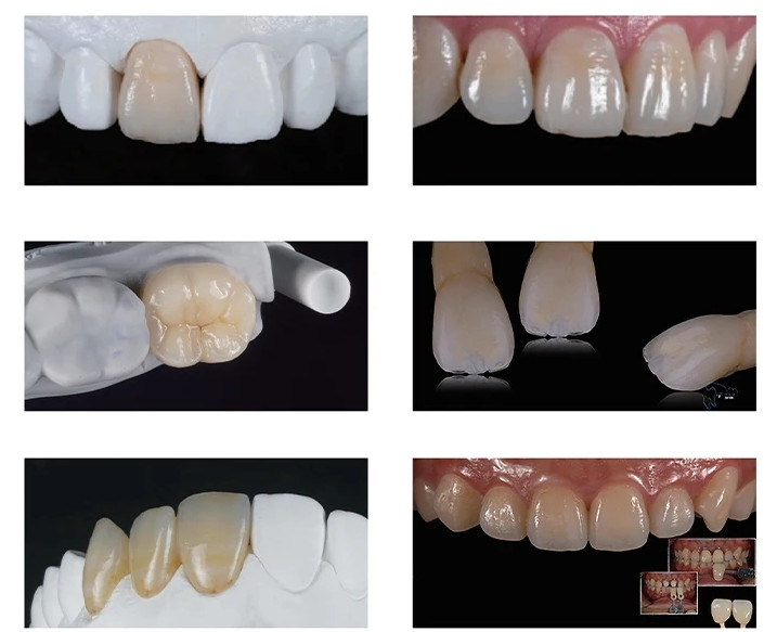 US LT Lithium Disilicate Blocks C14 Dental Glass Ceramic Cubes CAD CAlM Cerec