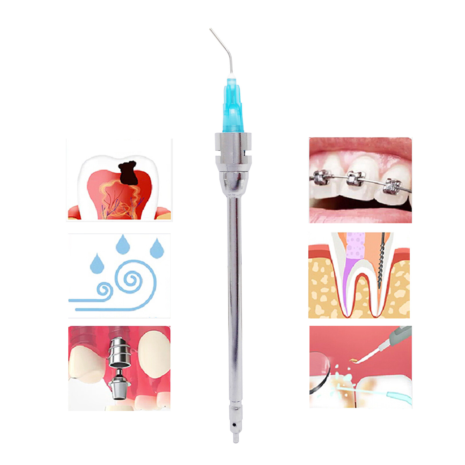 Dental Sybronendo Stropko Style Air Water Irrigator Irrigation Syringe Tips