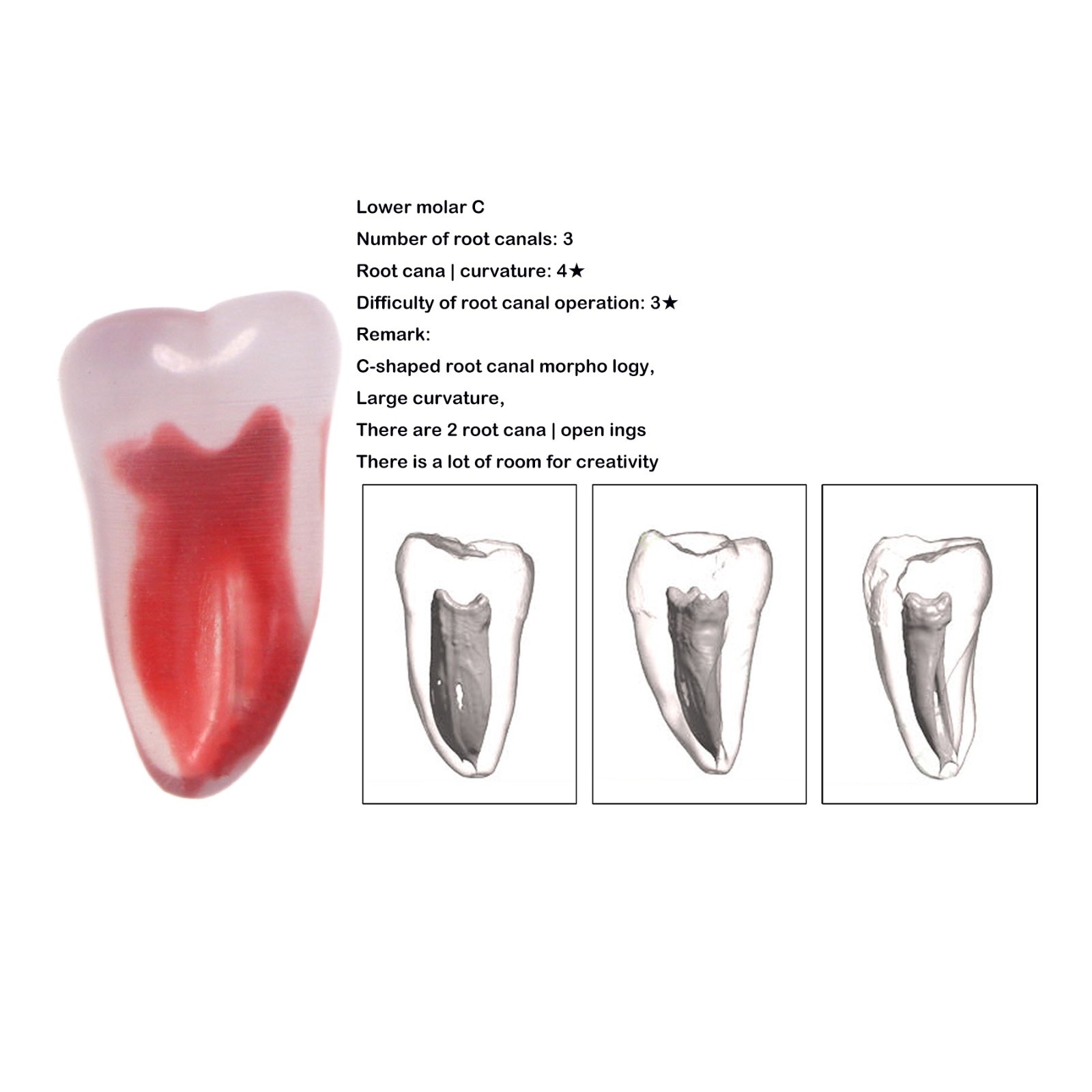 Dental Training 3D RCT Endo Tooth Model Practice Model Curved Root Resin Teeth