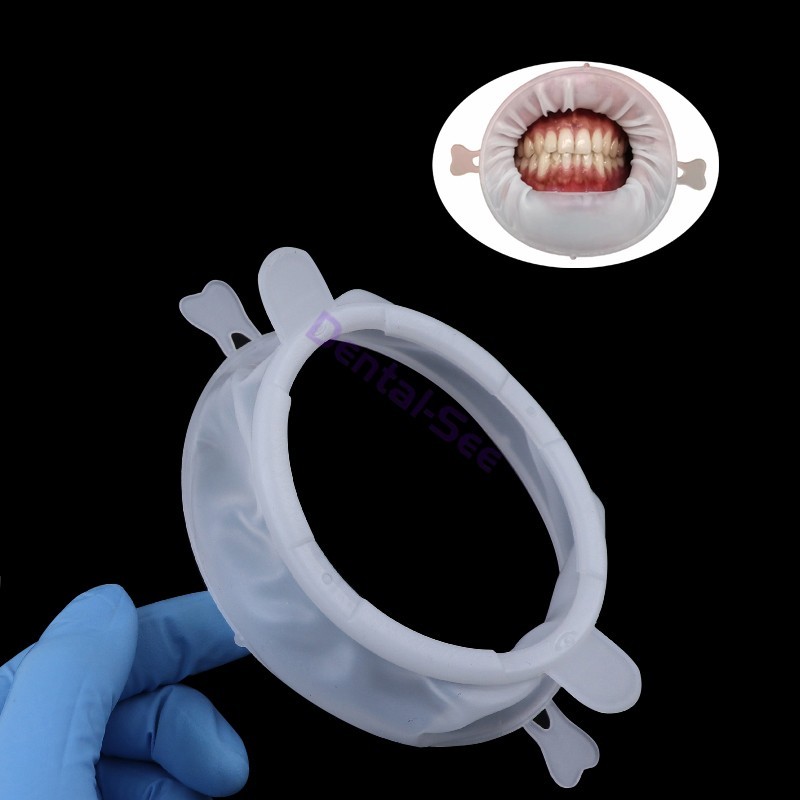Dental Cheek Retractor O Shape Rubber Dam 3D Lip Teeth Whitening Mouth Opener
