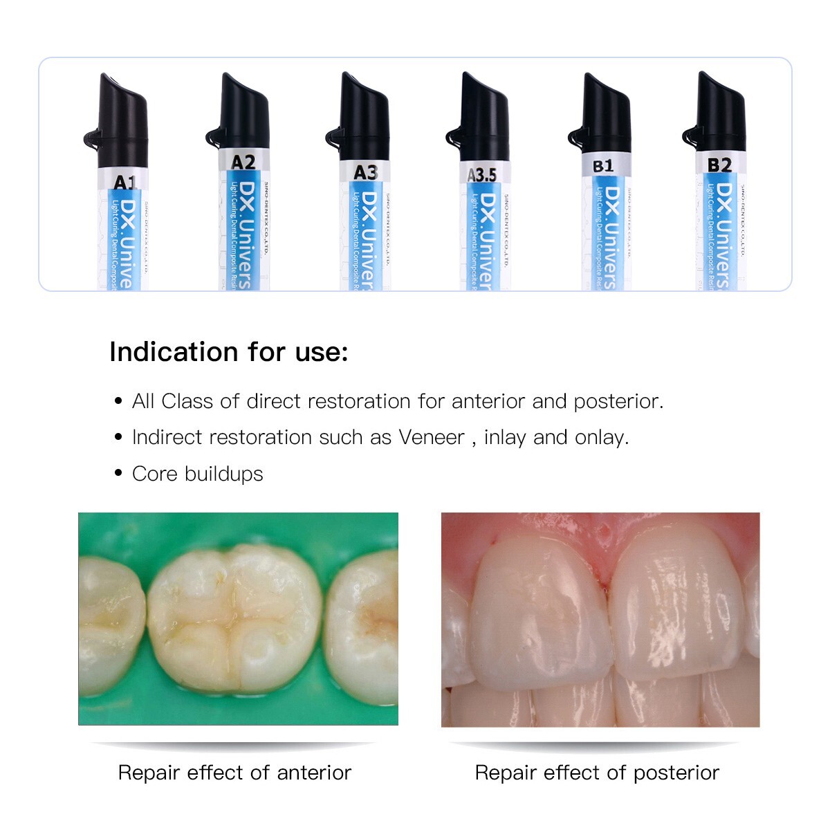 Dental Light Cure Resin Dentin Enamel / Visible Adhesive/ 37% Acid Etching Gel
