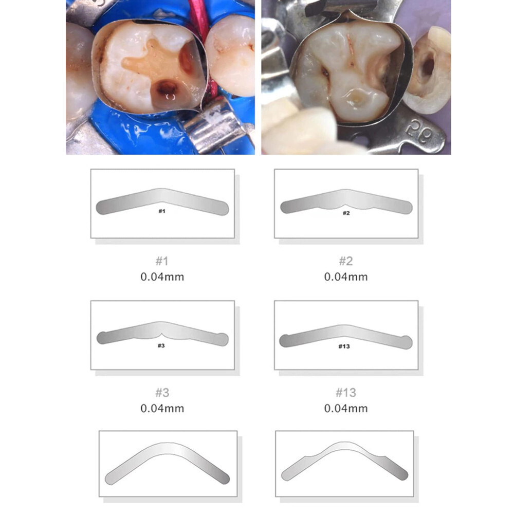 Dental Universal Matrix Band Tofflemire Stainless Steel Matrice Forming Pieces