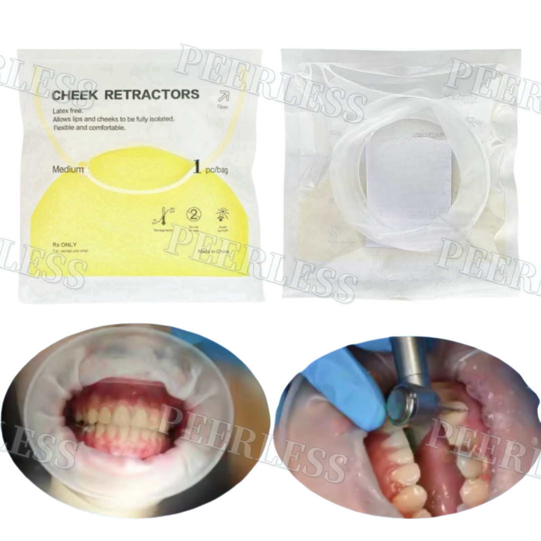 Dental Mouth Opener Lip Cheek Retractors O Shape Intraoral Lip Expander Opener M