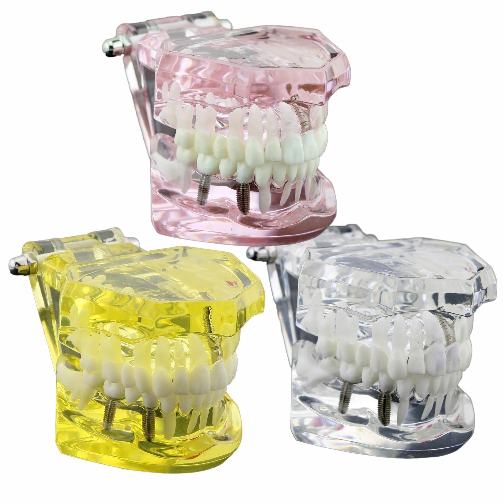 Dental Demonstration Model Teach Study Implant Bridge Restoration & Pathology