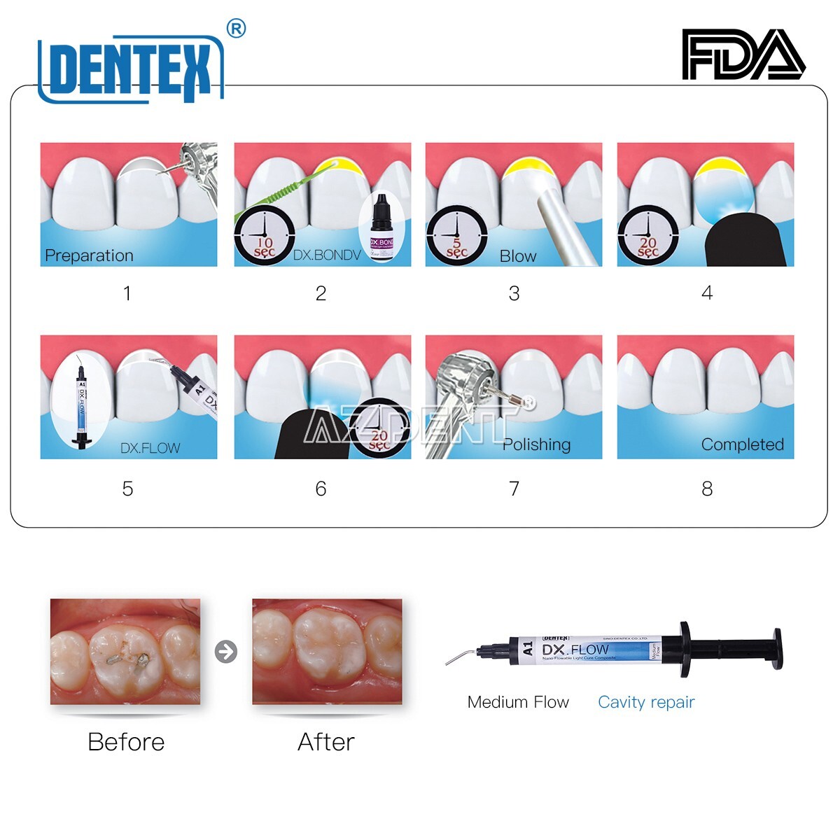 Dentex Dental Universal /Flowable Medium Flow Light Cure Composite Resin Refill