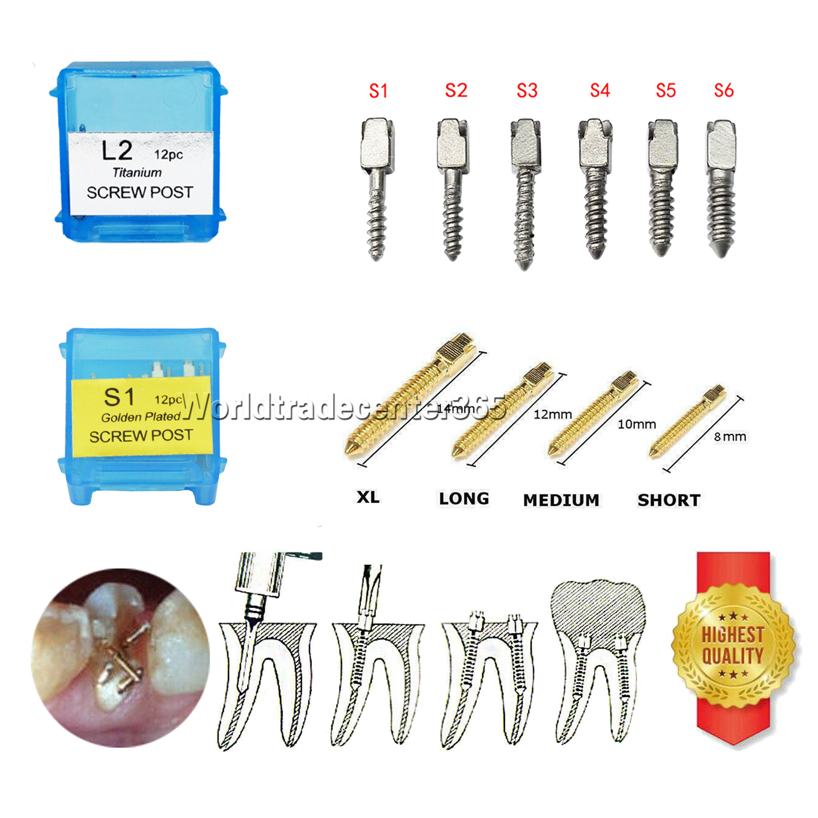 Dental NORDIN Style Endo 24K Golden Plated/Pure TITANIUM Root Canal Screw Post