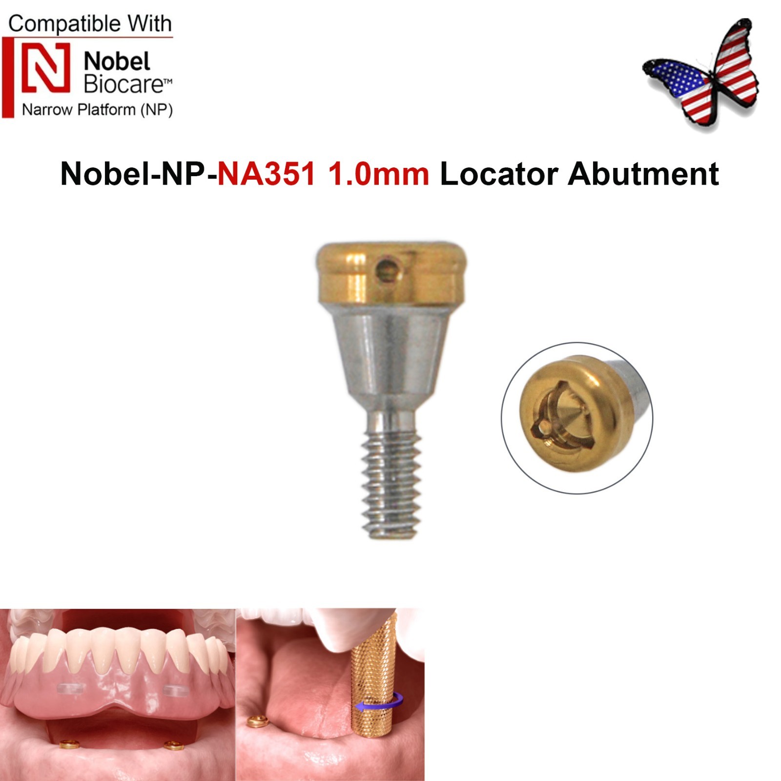 US Dental Locator Abutment NP/RP 3.5/4.3mm Fits Nobel Active Implant Overdenture
