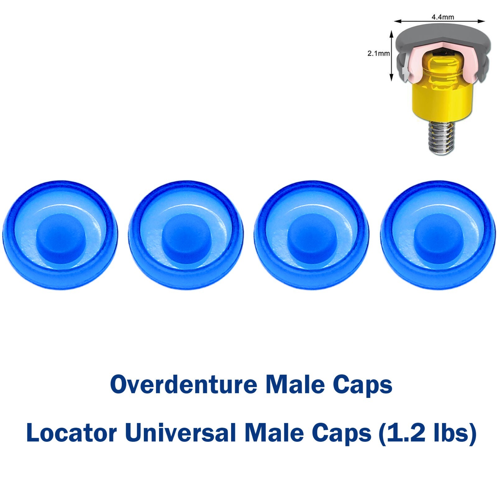 Implant Multi-Unit Locator Abutment ∅4.8mm& Male Caps fits Hiossen Nobel Active