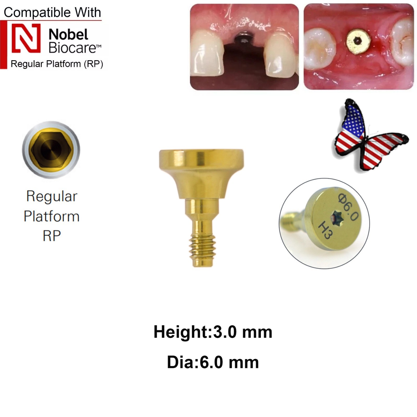5Pcs Nobel active Healing Abutment Cover Screw Healing Screw Gum Molding Implant