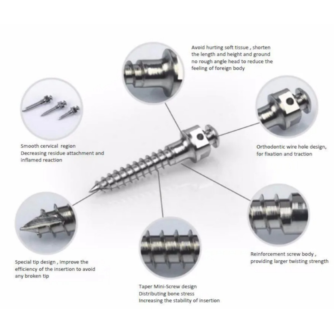 10Pcs Dental Mini Implant Micro Screw Orthodontic Screw Titanium TAD 14 Size USA