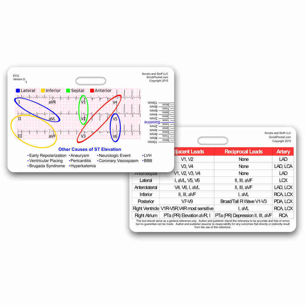 12 Lead STEMI Tool w/ Corresponding Vessels Chart Horz Badge Card Cheat Sheet