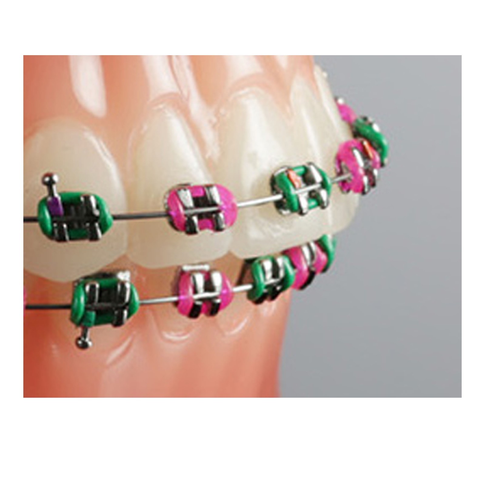 Morelli Dental Orthodontic Elastic Ligature Modules Assorted Crystal 1000pcs