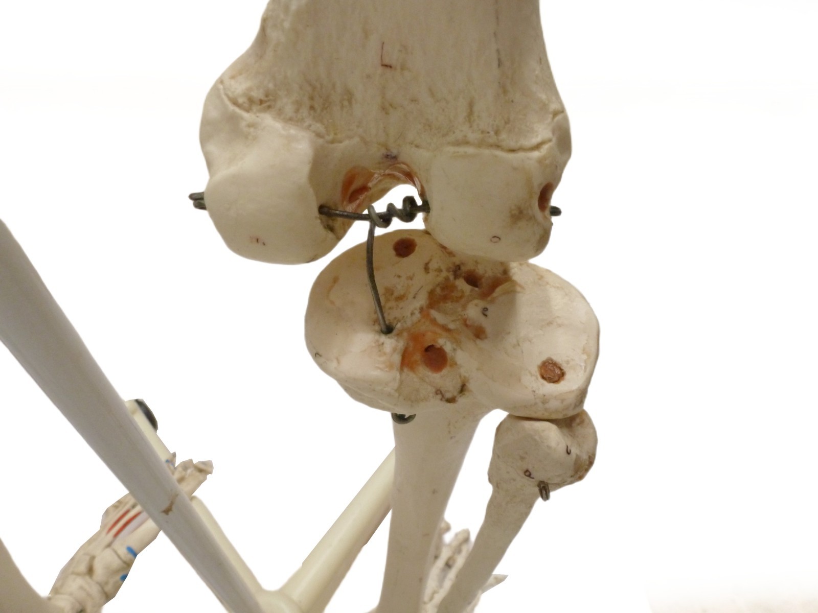 3B Scientific SAM A13 Skeleton Model Life Size Pelvic Stand Missing Muscles