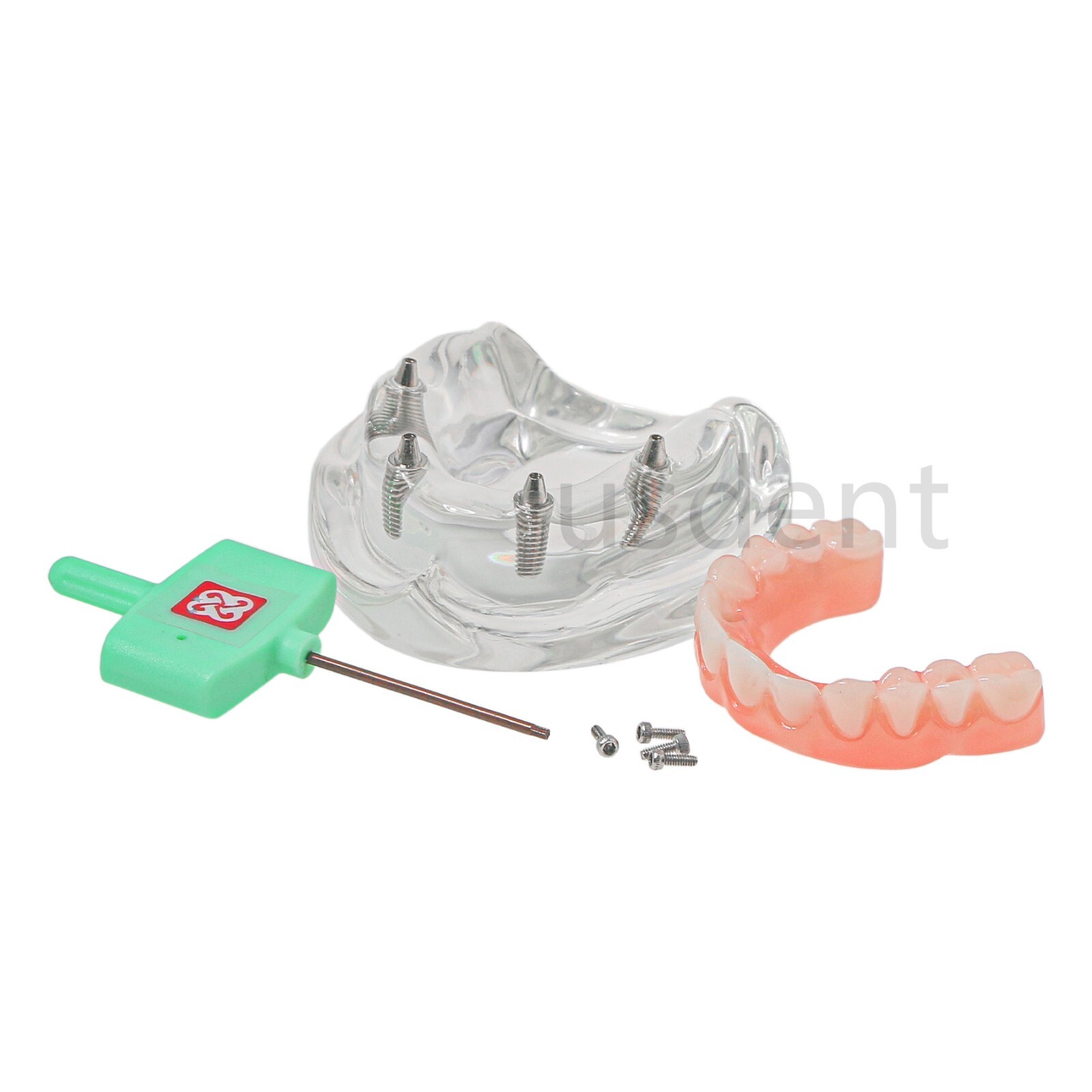 All on 4 Dental Implant Model Overdenture Upper Jaw 4 Implant Clear Detachable
