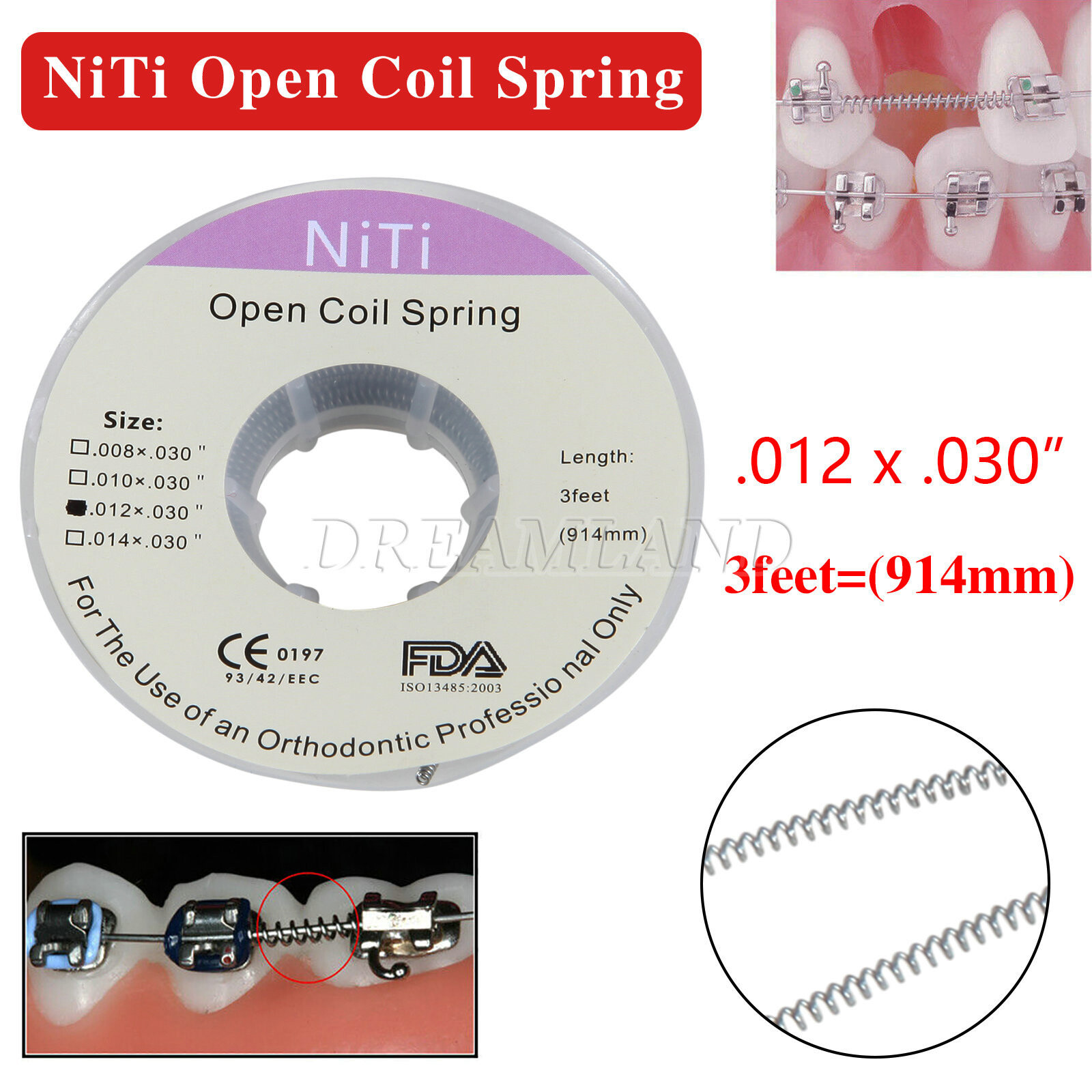 1 Roll Dental Orthodontic Niti Open Coil Spring Spool Dia.012 *030 ” inch 914mm