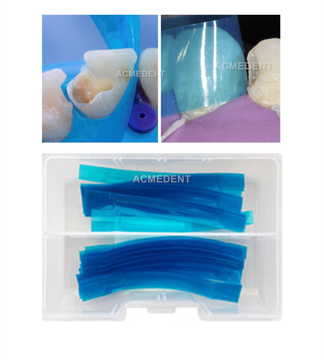 Dental Blue Strip Anterior Teeth Restoration Universal Resin Matrix