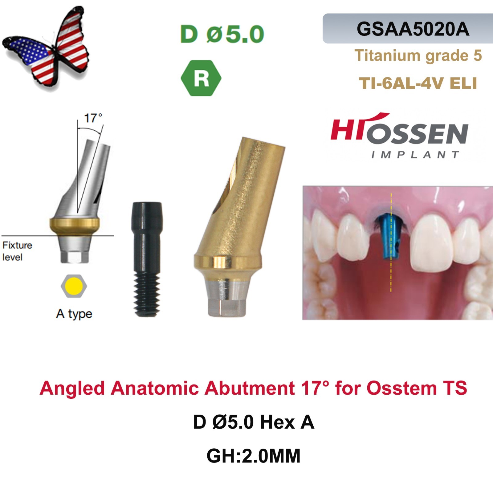 Dental 17° Angled Abutment Regular Ø5.0mm Hex A/B GH2/4 Fit Osstem TS Hiossen ET