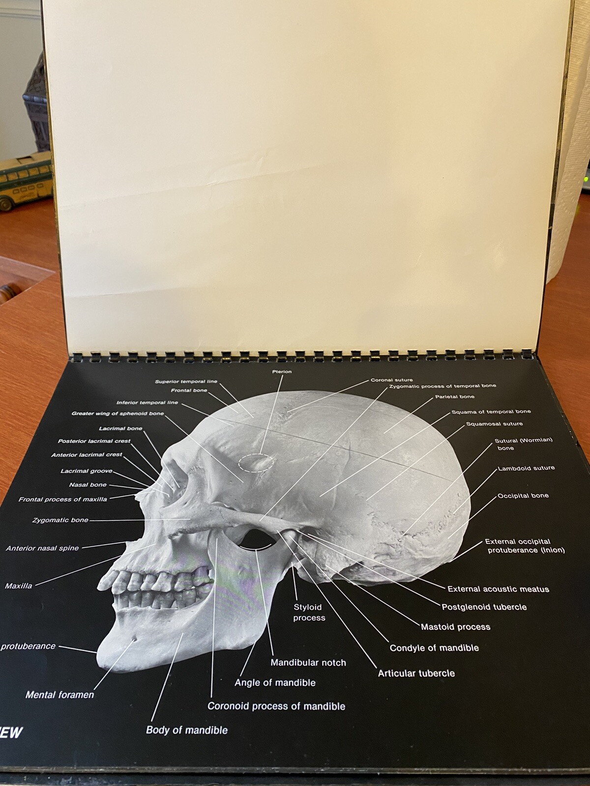 An Atlas of the Human Skull Eugene Kindley1980 – Large Format Photo Book – Rare